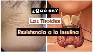 Tiroides y Resistencia a la insulina  Mente de Mujer por Carolina HD [upl. by Eillod580]