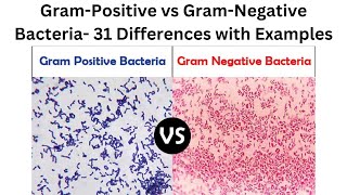 Gram Positive vs Gram Negative Bacteria 31 Differences with Examples [upl. by Shanie]