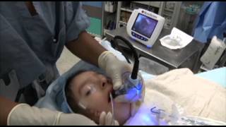 GlideScope Pediatric Airway Rounds Case Study 4 yearold Goldenhar Syndrome [upl. by Shulock]