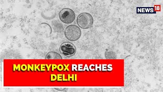 Monkey Pox  1st Confirmed Monkeypox Case In Delhi 4th Case In India  English News [upl. by Ettari805]