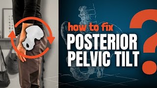 How to Fix Posterior Pelvic Tilt Complete Guide  Exercises [upl. by Hagar]