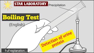 Urine protein testurine testurine test proteinurine test procedureurine reagent strip testurine [upl. by Sosna]