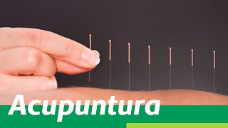 Medicina Integrativa Os benefícios da Acupuntura [upl. by Krefetz]