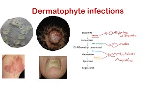 Dermatophytes Ring worm Superficial fungal infection Dermatology [upl. by Trista873]