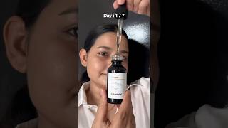 Minimalist 10 Vitamin C Serum Review 7 Days Challenge 7dayschallenge minimalist ashortsaday [upl. by Fogg]