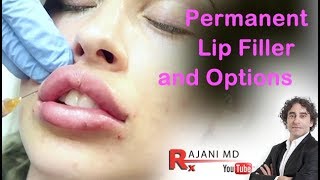 Permanent Lip Filler and OptionsDr Rajani [upl. by Acirej]