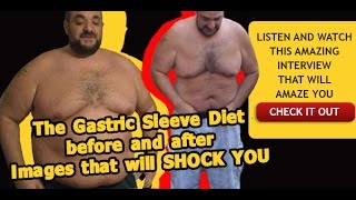 The Gastric Sleeve Diet before and after video that will simply SHOCK YOU [upl. by Icken]