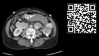 Mastering CT Abdomen and Pelvis Emergency Course [upl. by Sabas]