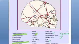 Obstetrics 118 Fetal Skull Diameters measurements [upl. by Eatton314]