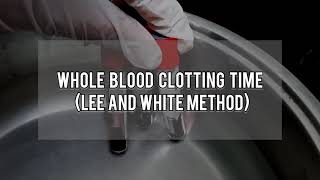 Whole Blood Clotting Time Procedure Lee and White Method [upl. by Zolly]