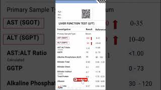 تحليل تشخيص التهاب الكبد hepatitis liverdisorders [upl. by Hessney552]