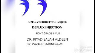 Deflux Injection [upl. by Llednahc721]