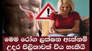 මෙම රෝග ලක්ෂන ඈත්නම් උදර පිලිකාවක් විය හෑකියි  Stomach Cancer Symptoms [upl. by Huberto]