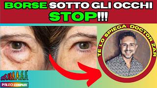 🟢STOP BORSE SOTTO GLI OCCHI ➡️RIMEDI INFALLIBILI [upl. by Juley]