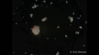 One Disease  Scabies mites [upl. by Sirrep937]