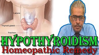 Hypothyroidism in Hindi  Discussion and Treatment in Homeopathy by Dr PS Tiwari [upl. by Aniluj]