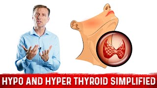 Hyperthyroid vs Hypothyroid Explained By Dr Berg [upl. by Razaele]