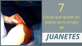 7 COSAS QUE QUIZÁS NO SABÍAS DE LA CIRUGÍA DE JUANETES [upl. by Yulma]