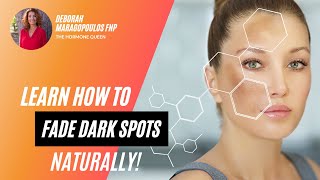 Learn How To Fade Dark Spots Naturally on Your Face [upl. by Aelsel]