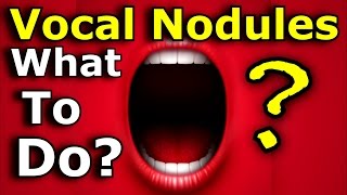 Vocal Nodules  Nodes  Polyps  What To Do  Ken Tamplin Vocal Academy [upl. by Adnole]