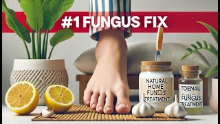 1 Toenail Fungus Treatment 10 MustTry Home Remedies [upl. by Yenohtna]