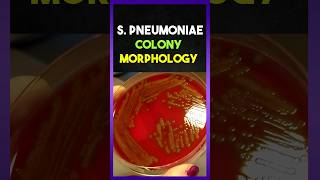 Streptococcus Pneumoniae Colony morphology [upl. by Odlaumor224]