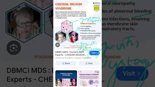 1 min OP chediak Higashi syndrome features oralpath dentistry syndromes chediak op mds [upl. by Ramar]