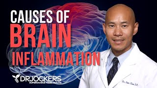 Causes Of Brain Inflammation Dr David Jockers [upl. by Chud]