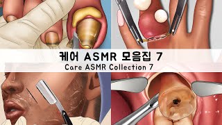 ASMR 케어 애니메이션 모음집7 내성발톱머릿니충치사랑니  CARE ANIMATION COLLECTION7 Ingrown toenailshead licecavities [upl. by Hadias]