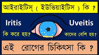 anterioruveitis iritis Iritis or Anterior uveitis symptoms signs and treatment discussed [upl. by Telford728]