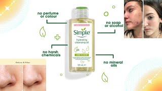 Simple Hydrating Cleansing Oil Review Kind To Skin How To Use [upl. by Luis]