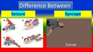 Difference Between Seizure and Syncope [upl. by Fleur]