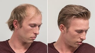 Medium Length Haircut For Men  Transformation with Hairsystem  Hairsystems Heydecke [upl. by Donelle]