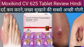 Moxikind cv 625 Tablet ke Fayde Moxikind cv 625 Tablet Uses in Hindi Antibiotics Tablet [upl. by Iralam889]