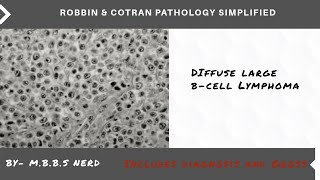 Difuse Large BCell Lymphoma NEET PG and University Examinations [upl. by Berti714]