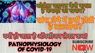 Pathophysiology of Covid19 SARS Cov2 in hindi [upl. by Leiahtan]