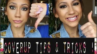 How To CoverUp Acne Spots My Tips amp Tricks [upl. by Emmeram239]