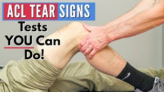 Top 3 Signs You Have an ACL tear Tests You Can Do At Home [upl. by Granville]