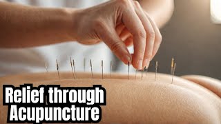 The Life Of A Acupuncturist [upl. by Englis]