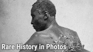 The Untold Story of Gordon the Whipped Louisiana Slave  Rare History in Photos [upl. by Oiliduab]