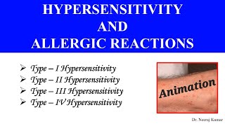 Type I II III amp IV Hypersensitivity Animation  Allergic reactions [upl. by Orfield]