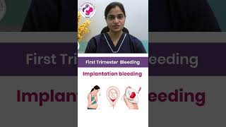 Is Implantation Bleeding Causing Your Spotting Watch Dr Mayuri Kothiwala’s Expert Guide [upl. by Mattie]