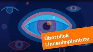 Überblick Linsenimplantate  MUNICH EYE [upl. by Alym]