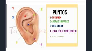 AURICULOTERAPIA Para Ansiedad ► PUNTOS DE acupuntura para reducir ansiedad y estrés Auriculopuntura [upl. by Riorsson592]