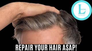 How to Regrow Your Hair amp Repair It Fast [upl. by Nosila]