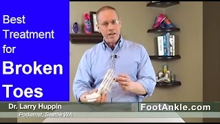 What is the Best Treatment for a Broken Toe and why you should NEVER buddy tape a stubbed toe [upl. by Aylmer897]