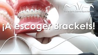 Ortodoncia ideal TIPOS DE BRACKETS  Ortodoncia MVM en Bogotá  Colombia [upl. by Lagasse]