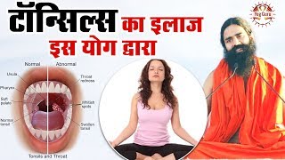 Baba Ramdev  उज्जायी प्राणायाम से ठीक करे बच्चों का टॉन्सिल 1 दिन में  How to do Ujjayi Pranayam [upl. by Torto]