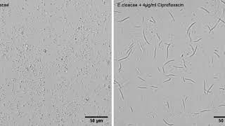 Enterobacter cloacae morphological change upon Ciprofloxacine treatment  Filamentation [upl. by Luckin59]