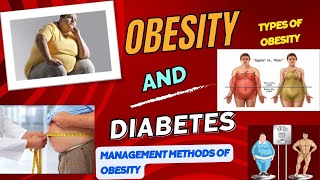 Obesity and Diabetes Types and Management of Obesity [upl. by Etnad754]